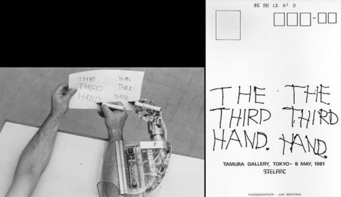 Stelarc »Third Hand«